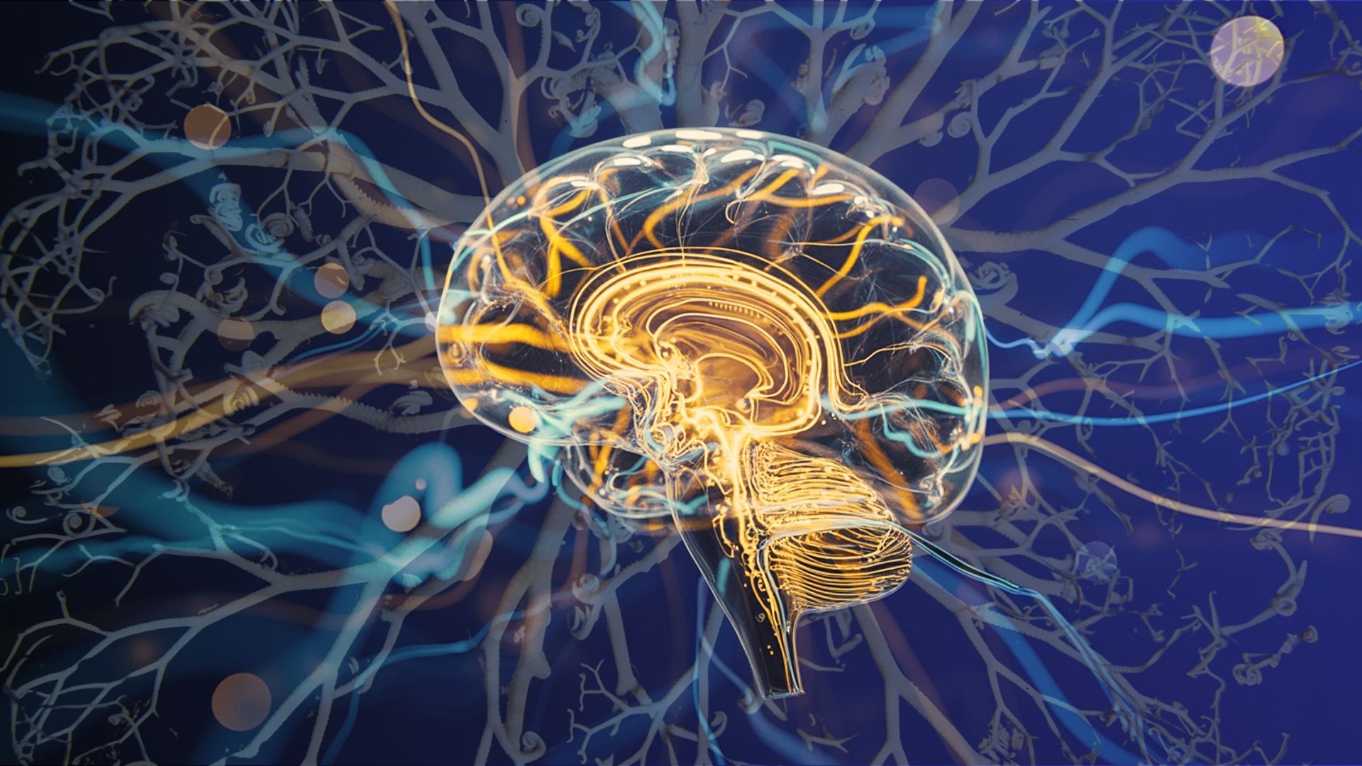 An image of neurodivergent brain