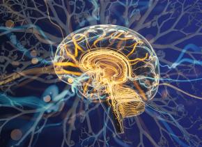 An image of neurodivergent brain
